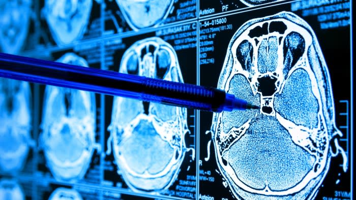 Per curare le malattie, l’intelligenza artificiale ha bisogno di una maggiore quantità di dati